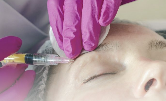 Injection de toxine botulique