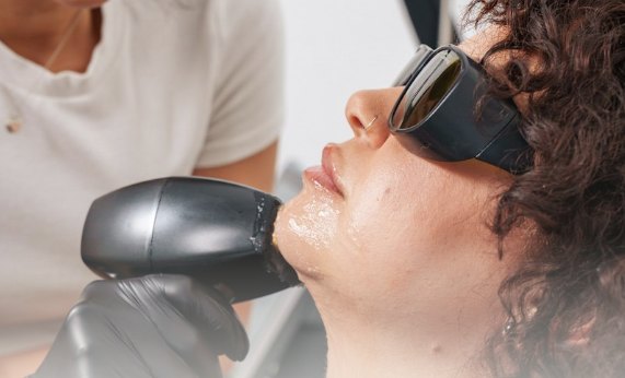 Séance d'épilation laser
